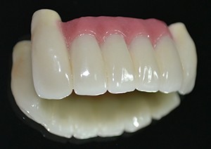 implant